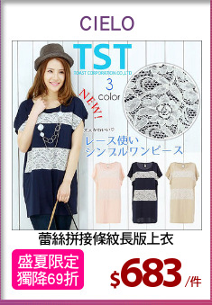 蕾絲拼接條紋長版上衣